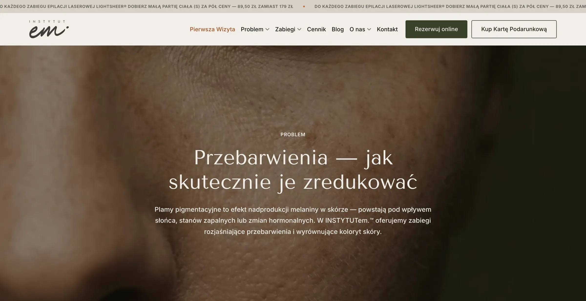 Podstrona problemu: od opisu przyczyny do zabiegu i ceny.
